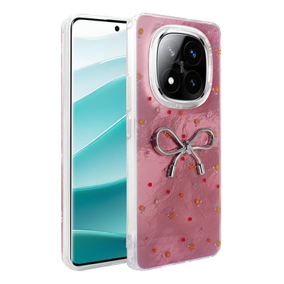 Xiaomi Redmi Note 14 Pro Plus Kılıf Kamera Korumalı Figürlü Zore Ponti Silikon Kapak Lila